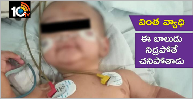 ఇదో వింత వ్యాధి: ఈ బాలుడు నిద్రపోతే చనిపోతాడు ఇదో వింత వ్యాధి: ఈ బాలుడు నిద్రపోతే చనిపోతాడు