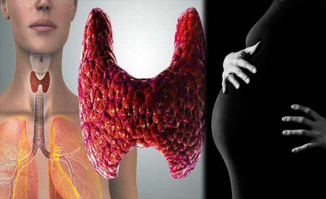 Thyroid Problem, Infertility Risk, healthy lifestyle