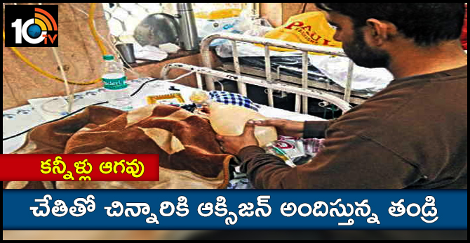 DELHI MAN TO SAVE HIS CHILD GIVING OXIGEN BY AMBU BAG