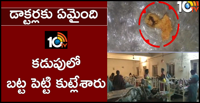 Govt Hospital Staff Nurse Forgets Cloth Inside Patient's Stomach | East Godavari