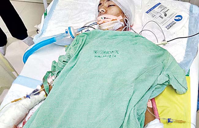 Hyderabad Yashoda  hospital in madurai health on ventilator
