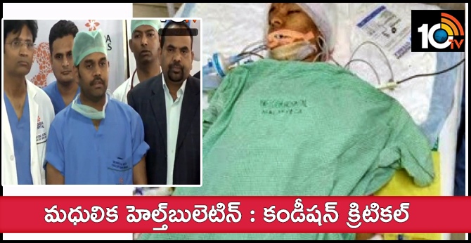 Madhulika | Malakpet Yashoda Hospital Doctors Release Health Bulletin