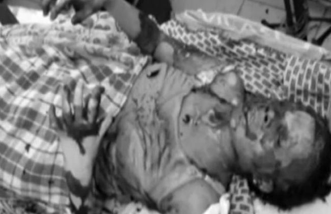 petrol attack at warangal