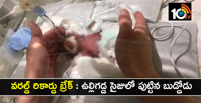 వరల్డ్ రికార్డు బ్రేక్ : ఉల్లిగడ్డ సైజులో పుట్టిన బుడ్డోడు వరల్డ్ రికార్డు బ్రేక్ : ఉల్లిగడ్డ సైజులో పుట్టిన బుడ్డోడు