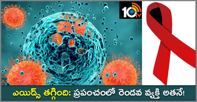 ఎయిడ్స్ తగ్గింది: ప్రపంచంలో రెండవ వ్యక్తి అతనే! ఎయిడ్స్ తగ్గింది: ప్రపంచంలో రెండవ వ్యక్తి అతనే!