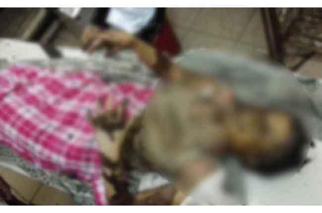 Warangal Ravali Health Condition Very Critical