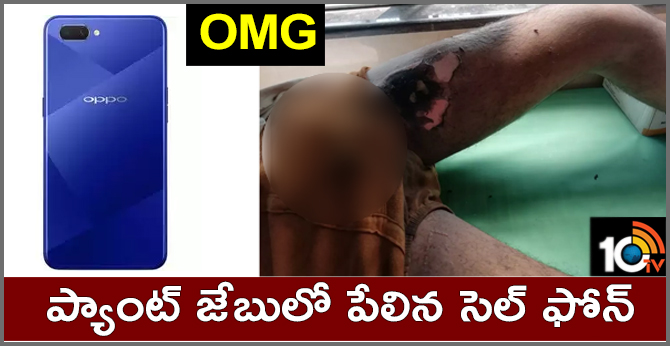 OMG : ప్యాంట్ జేబులో పేలిన సెల్ ఫోన్ OMG : ప్యాంట్ జేబులో పేలిన సెల్ ఫోన్