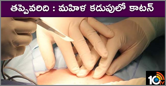 pregnant women operation .. cotton infection in siddipet Government hospital