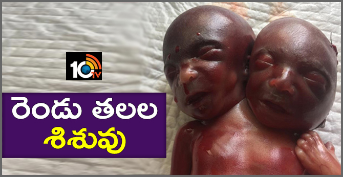 Two headed baby boy born