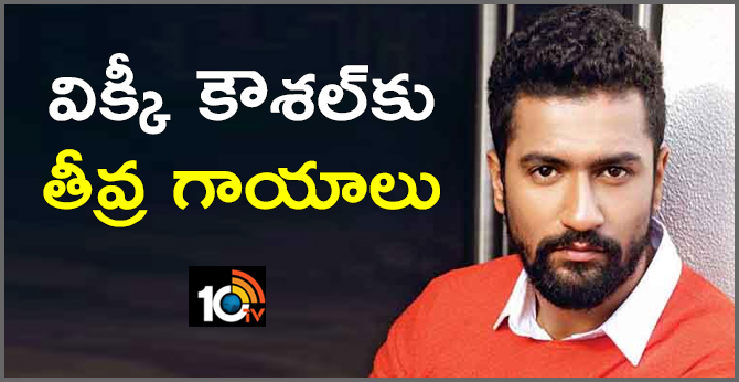 Vicky Kaushal Injured While Movie Shooting-10TV