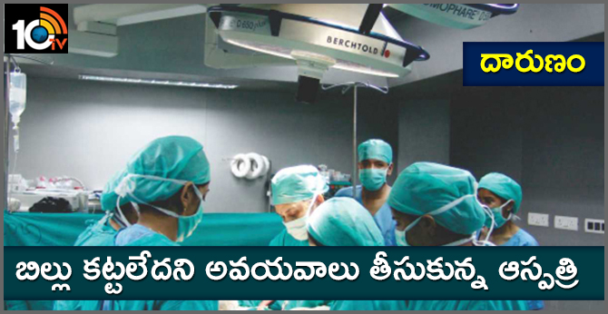దారుణం : బిల్లు కట్టలేదని అవయవాలు తీసుకున్న ఆస్పత్రి దారుణం : బిల్లు కట్టలేదని అవయవాలు తీసుకున్న ఆస్పత్రి