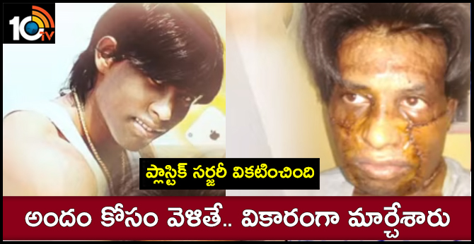 BHEEMAVARAM SIVA MENTALLY IMBALANCED AFTER PLASTIC SURGERY