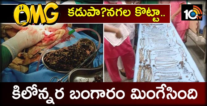 OMG వీడియో:కడుపా?నగల కొట్టా..కిలోన్నర బంగారం మింగేసింది OMG వీడియో:కడుపా?నగల కొట్టా..కిలోన్నర బంగారం మింగేసింది
