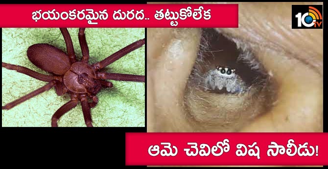 She Thought She Had Water In Ear - It Was A Venomous Brown Recluse Spider