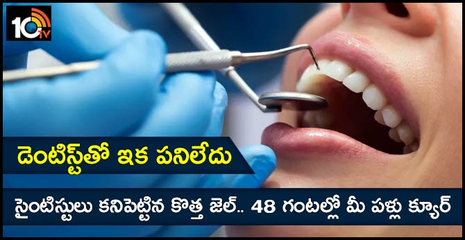 డెంటిస్ట్తో ఇక పనిలేదు : సైంటిస్టులు కనిపెట్టిన కొత్త జెల్.. 48 గంటల్లో మీ పళ్లు క్యూర్ డెంటిస్ట్తో ఇక పనిలేదు : సైంటిస్టులు కనిపెట్టిన కొత్త జెల్.. 48 గంటల్లో మీ పళ్లు క్యూర్