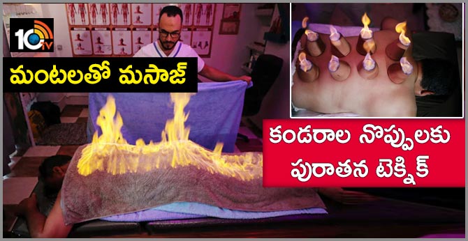 Playing With Fire: Masseur Uses Ancient Technique To Ease Muscle Pain