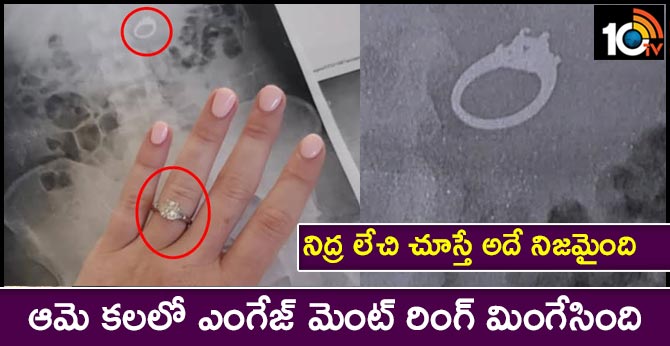 Woman Dreams Of Swallowing Engagement Ring, Wakes Up To Find She Actually Did