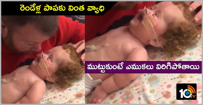 2Years Old Baby Girl With Genetic Problem Tries To Cheer Up Her Dad 