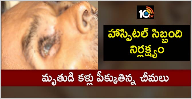 Ants Crawl On Dead Patients' Eye In Madhya Pradesh Hospital, 5 Suspended