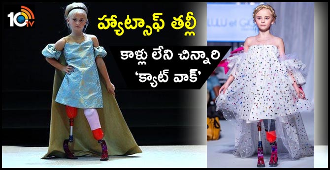 హ్యాట్సాఫ్ తల్లీ : కాళ్లు లేని చిన్నారి ‘క్యాట్ వాక్’ హ్యాట్సాఫ్ తల్లీ : కాళ్లు లేని చిన్నారి ‘క్యాట్ వాక్’