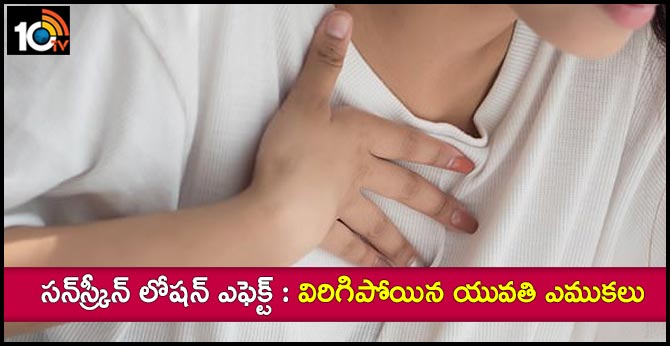 సన్స్క్రీన్ లోషన్ ఎఫెక్ట్ : విరిగిపోయిన యువతి ఎముకలు సన్స్క్రీన్ లోషన్ ఎఫెక్ట్ : విరిగిపోయిన యువతి ఎముకలు