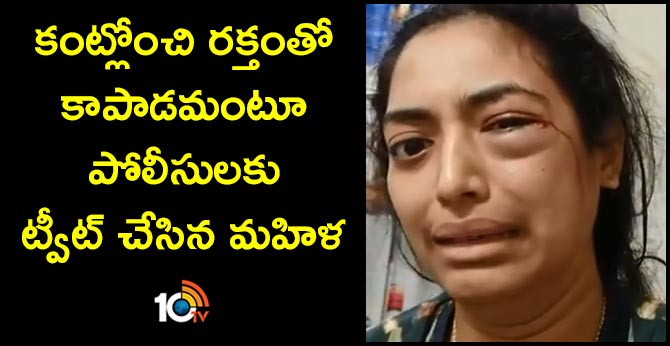 Indian Arrested In Sharjah After Video SOS Of Wife, Bleeding From Eye