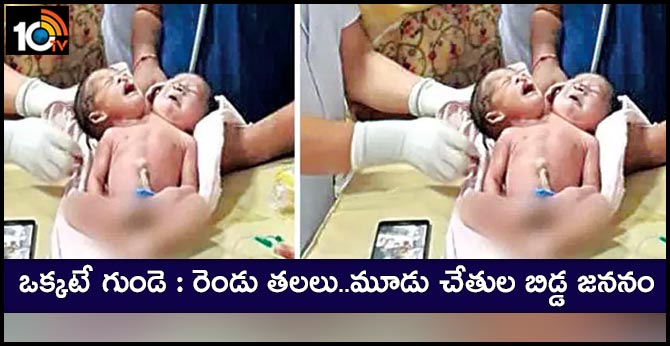 ఒక్కటే గుండె : రెండు తలలు..మూడు చేతుల బిడ్డ జననం ఒక్కటే గుండె : రెండు తలలు..మూడు చేతుల బిడ్డ జననం