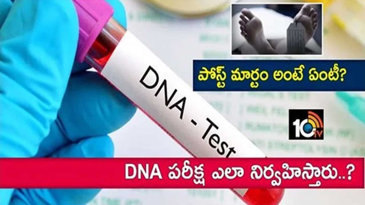 అయేషా కేసు : పోస్ట్ మార్టం అంటే ఏంటీ? DNA పరీక్ష ఎలా నిర్వహిస్తారు..? అయేషా కేసు : పోస్ట్ మార్టం అంటే ఏంటీ? DNA పరీక్ష ఎలా నిర్వహిస్తారు..?