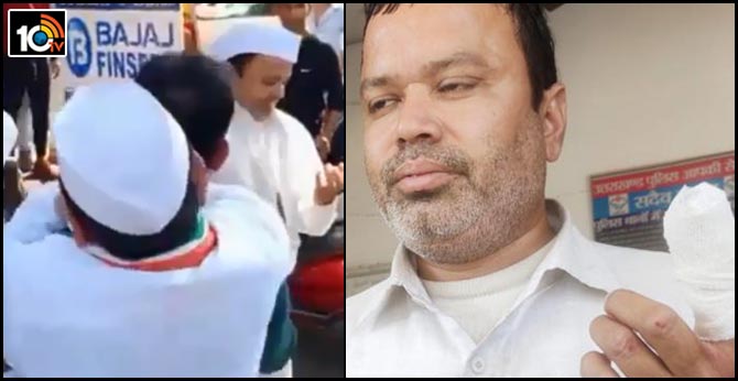 CONGRESS LEADER FINGER WAS BITTEN BY MAN OVER ONIONS SHORTAGE