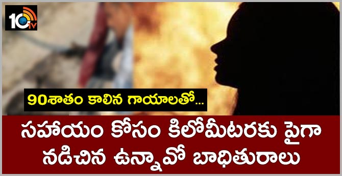 90శాతం కాలిన గాయాలతో…సహాయం కోసం కిలోమీటరకు పైగా నడిచిన ఉన్నావో బాధితురాలు 90శాతం కాలిన గాయాలతో…సహాయం కోసం కిలోమీటరకు పైగా నడిచిన ఉన్నావో బాధితురాలు