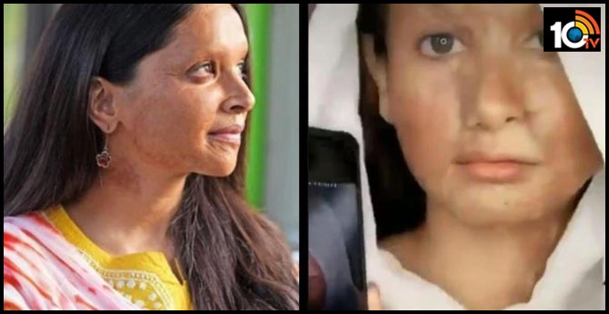 మరీ ఇంత చెత్త ప్రమోషనా: దీపికా పదుకొణె TikTok ఛాలెంజ్ మరీ ఇంత చెత్త ప్రమోషనా: దీపికా పదుకొణె TikTok ఛాలెంజ్
