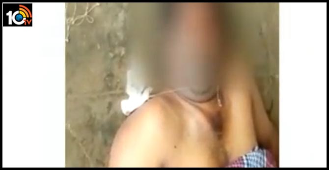 రక్షణ లేదా : మృతదేహం కళ్లను తినేసిన ఎలుకలు రక్షణ లేదా : మృతదేహం కళ్లను తినేసిన ఎలుకలు