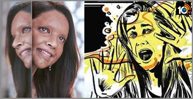 Chhapaak impact: Uttarakhand to start a pension scheme for acid attack survivors