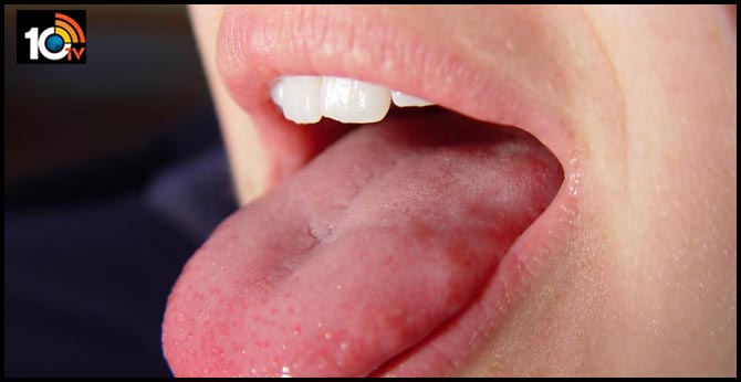 Here’s where bacteria live on your tongue cells