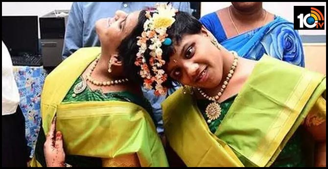The undivided twins Veena vani will attend the ssc exams, they write exams ownly
