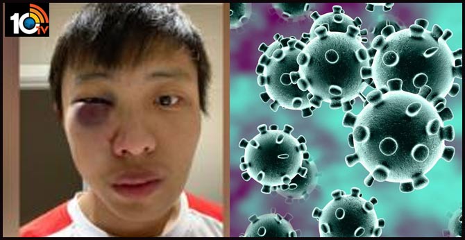 East Asian student assaulted in 'racist' coronavirus attack