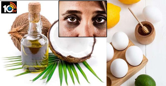 How To Get Rid Of Dark Circles At Home in lockdown time