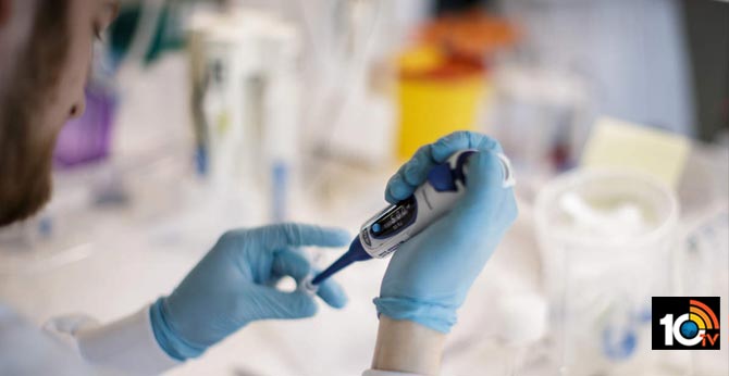 Which country will have Best Technologhy to control Coronavirus, What India should have learn from China, South Korea, Germany