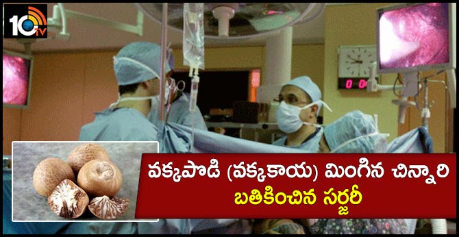 Tamil nadu doctors perform successful surgery on toddler who swallowed Areca nut