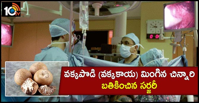 వక్కపొడి (వక్కకాయ) మింగిన చిన్నారి.. బతికించిన సర్జరీ వక్కపొడి (వక్కకాయ) మింగిన చిన్నారి.. బతికించిన సర్జరీ