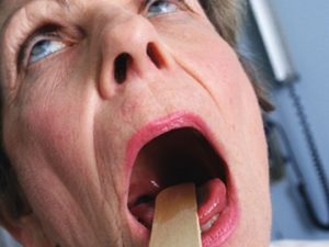 Are you suffering form Mouth rashes , it might be symptoms of Covid-19 