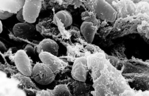 China issues bubonic plague alert, forbids eating risky animals