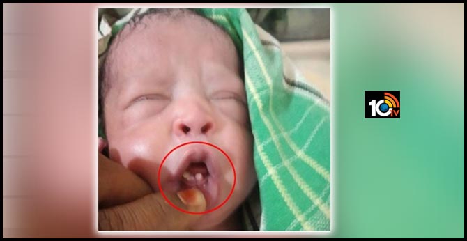 baby-born-with-teeth-in-telangana-jogulamba-dt