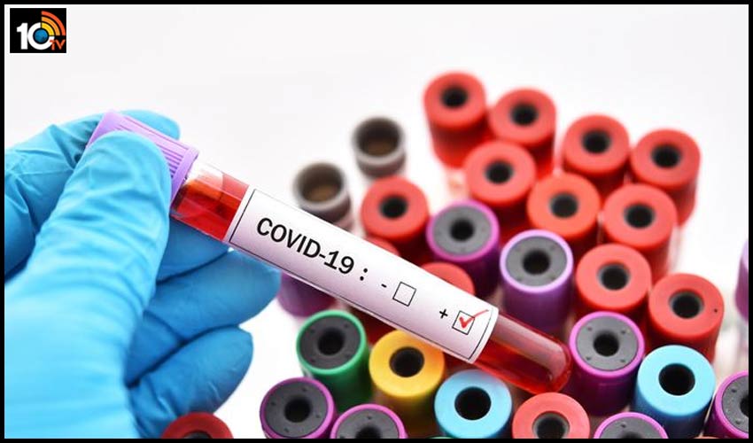 AP Covid-19 Live Updates : ఏపీలో కరోనా కల్లోలం.. ఇవాళ కూడా 10 వేలపైనే పాజిటివ్ కేసులు AP Covid-19 Live Updates : ఏపీలో కరోనా కల్లోలం.. ఇవాళ కూడా 10 వేలపైనే పాజిటివ్ కేసులు