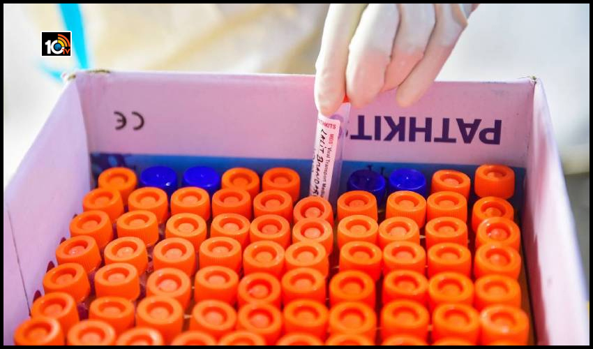 RT-PCR టెస్ట్ ధర తగ్గింది.. రూ.800 మాత్రమే RT-PCR టెస్ట్ ధర తగ్గింది.. రూ.800 మాత్రమే