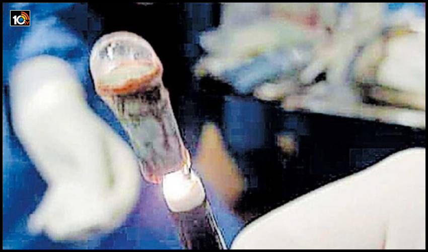 25 ఏళ్లుగా గొంతులో విజిల్ పెట్టుకుని తిరుగుతున్న మహిళ..!! 25 ఏళ్లుగా గొంతులో విజిల్ పెట్టుకుని తిరుగుతున్న మహిళ..!!