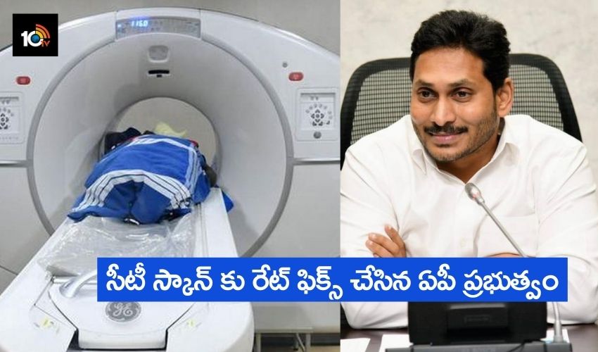 CT Scan Fix Rate : సీటీ స్కాన్ కు రేట్ ఫిక్స్ చేసిన ఏపీ ప్రభుత్వం CT Scan Fix Rate : సీటీ స్కాన్ కు రేట్ ఫిక్స్ చేసిన ఏపీ ప్రభుత్వం