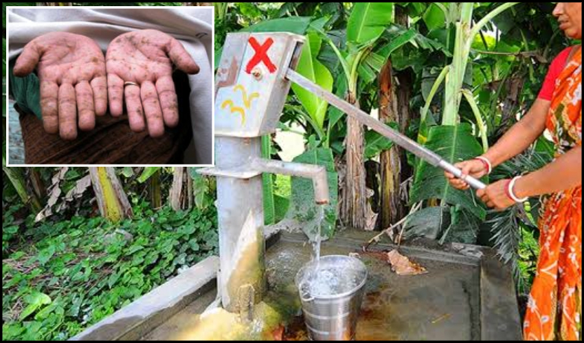 Arsenic Resources Effect On Telugu States, Water Polluted