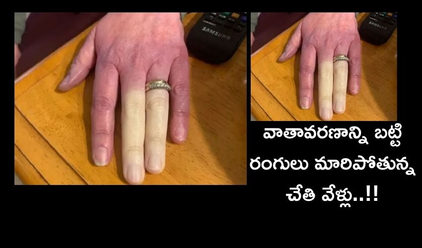 Fingers Changes