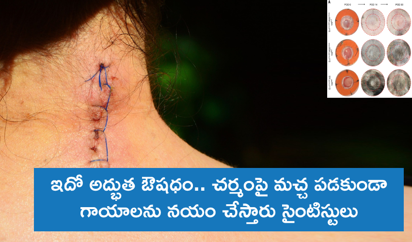 Scientists Heal Wounds Without Scar Tissue